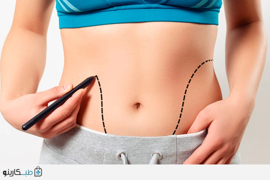 عمل پیکرتراشی